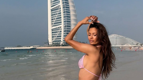 "У меня нет никаких шрамов": Боня ответила хейтерам