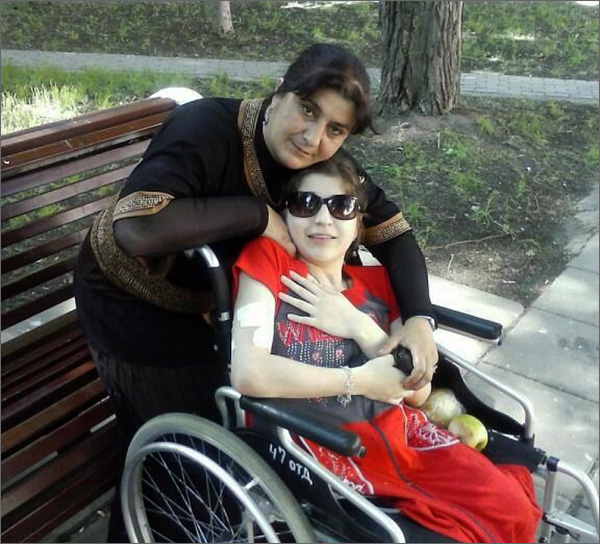 Скончалась Зита, одна из сиамских близнецов из Кыргызстана